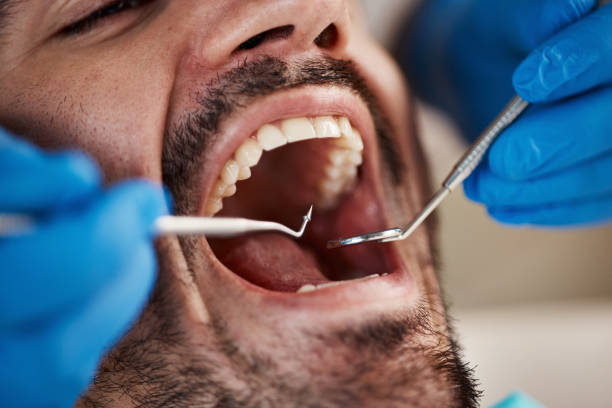 Best Cracked Tooth Emergency Dentist  in Piedmont, OK