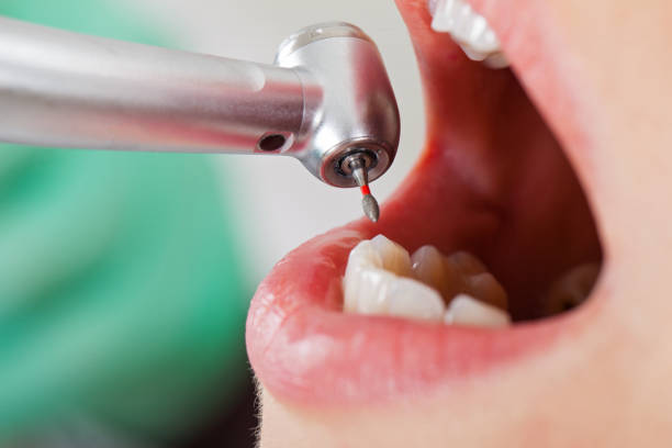 Best Root Canal Emergency Dentist  in Piedmont, OK